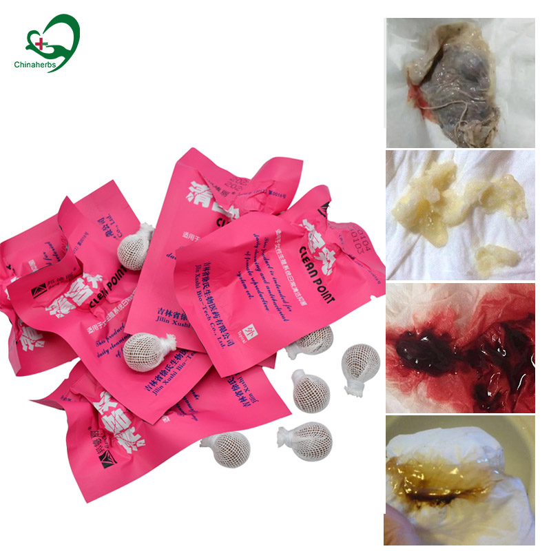 Medical Wellness & Spa Werona - 20 pçs yoni pérolas ponto limpo